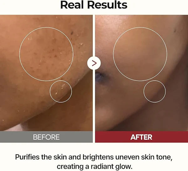 Peel Shot Glow Rice Ampoule