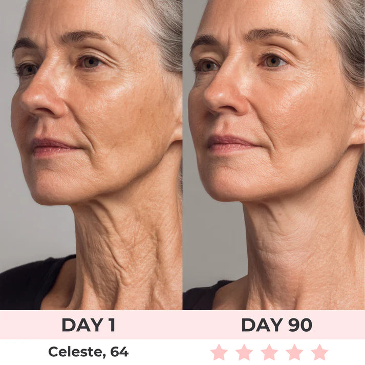 GlowLift IPL Device