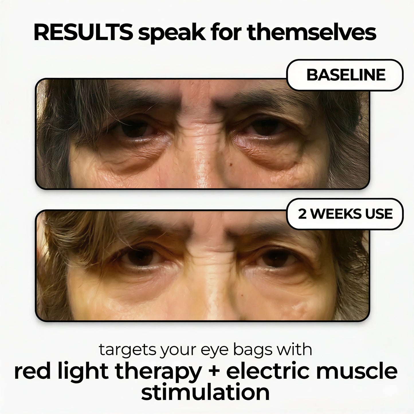 LumiEyes™ Advanced Red Light Eye Therapy