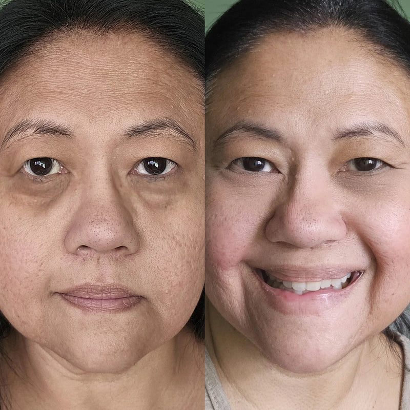 Brighter, Refreshed Eyes