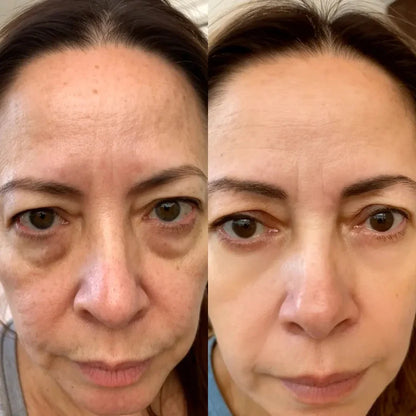 LumiEyes™ Advanced Red Light Eye Therapy