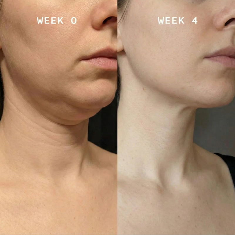 Clinic-Quality Results