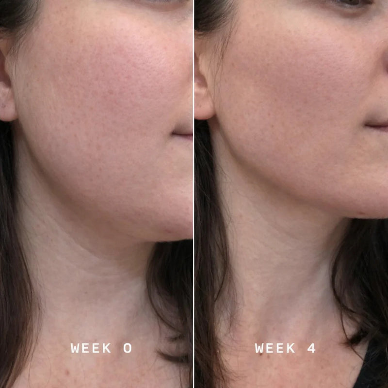 Suitable for All Skin Types