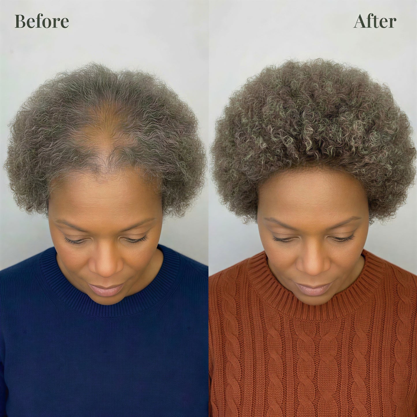 Hoegoa™ Root Renewal Shampoo