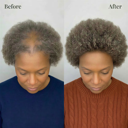 Hoegoa™ Root Renewal Shampoo