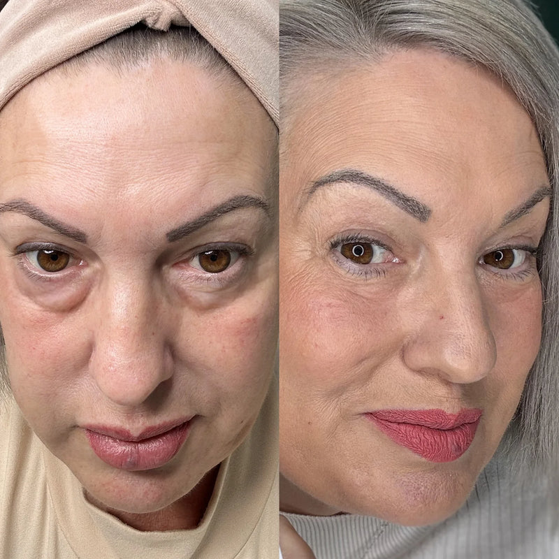 Suitable for All Skin Types